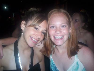 1 hoops, 2 wired mouth!