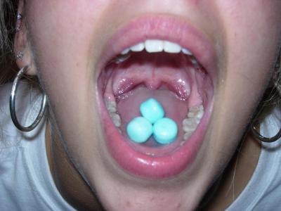 Hoops, mouth, but no face!? :-o