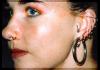Click to view ear16_t1.jpg